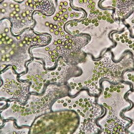 Cellule e cloroplasti di Asplenium nidus Cellule e cloroplasti di Asplenium nidus